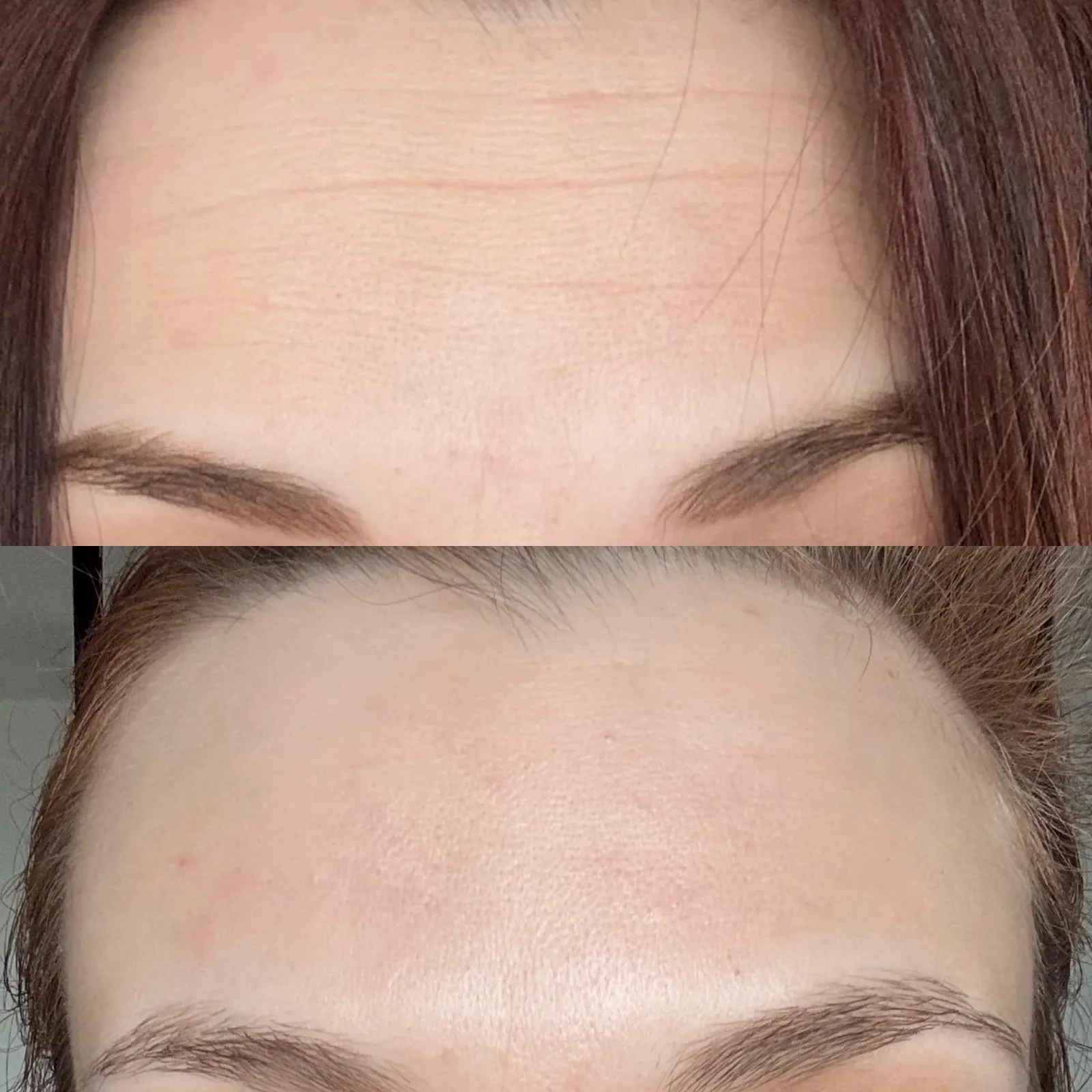 Jessica T. before and after