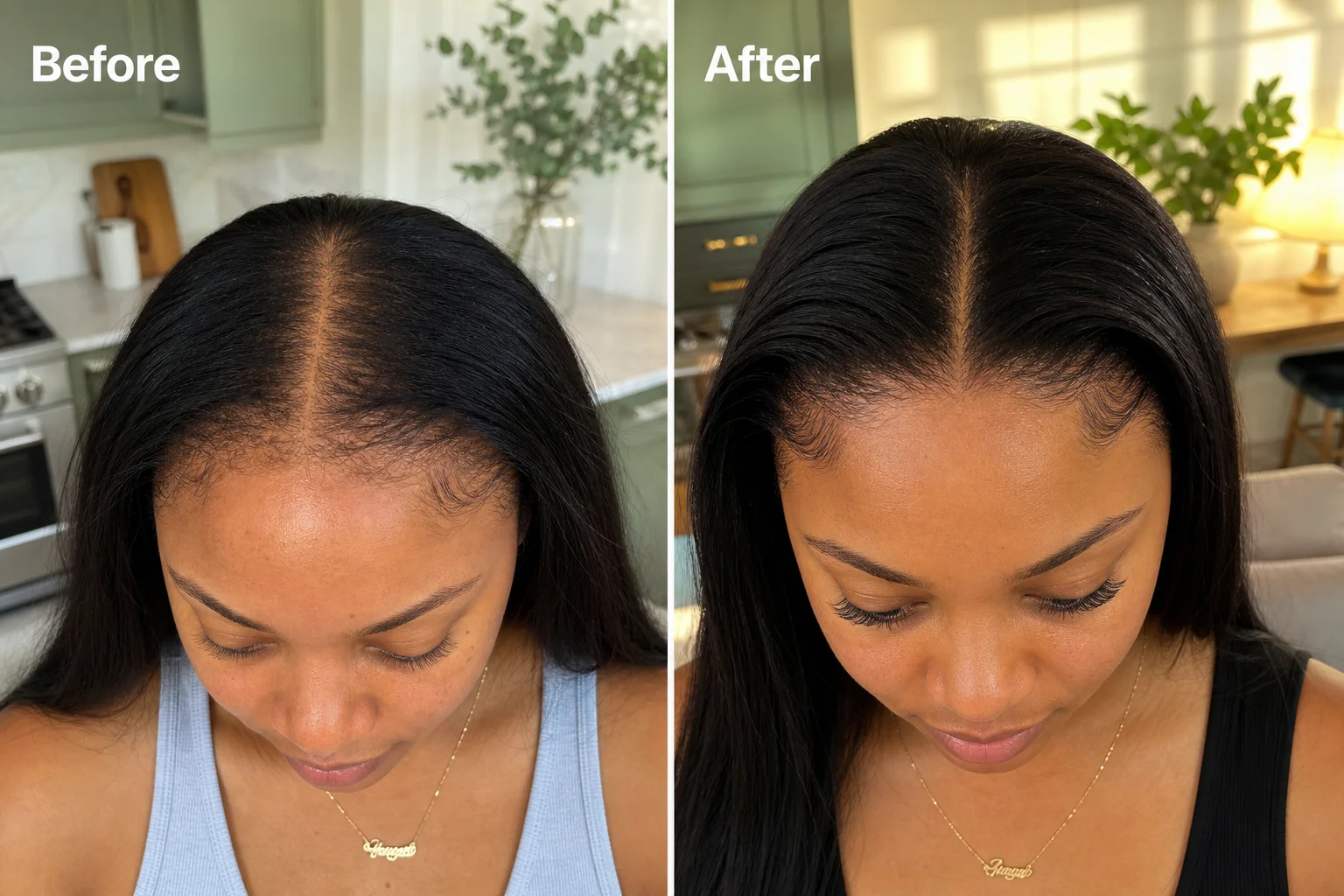 Natasha V. before and after